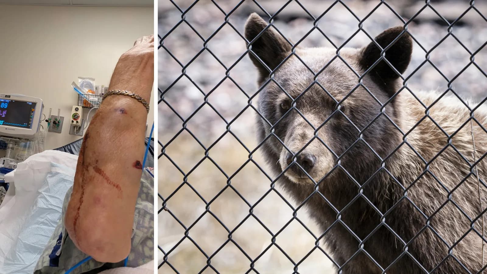Solo Hiker Recounts Black Bear Tent Attack Near South Fork